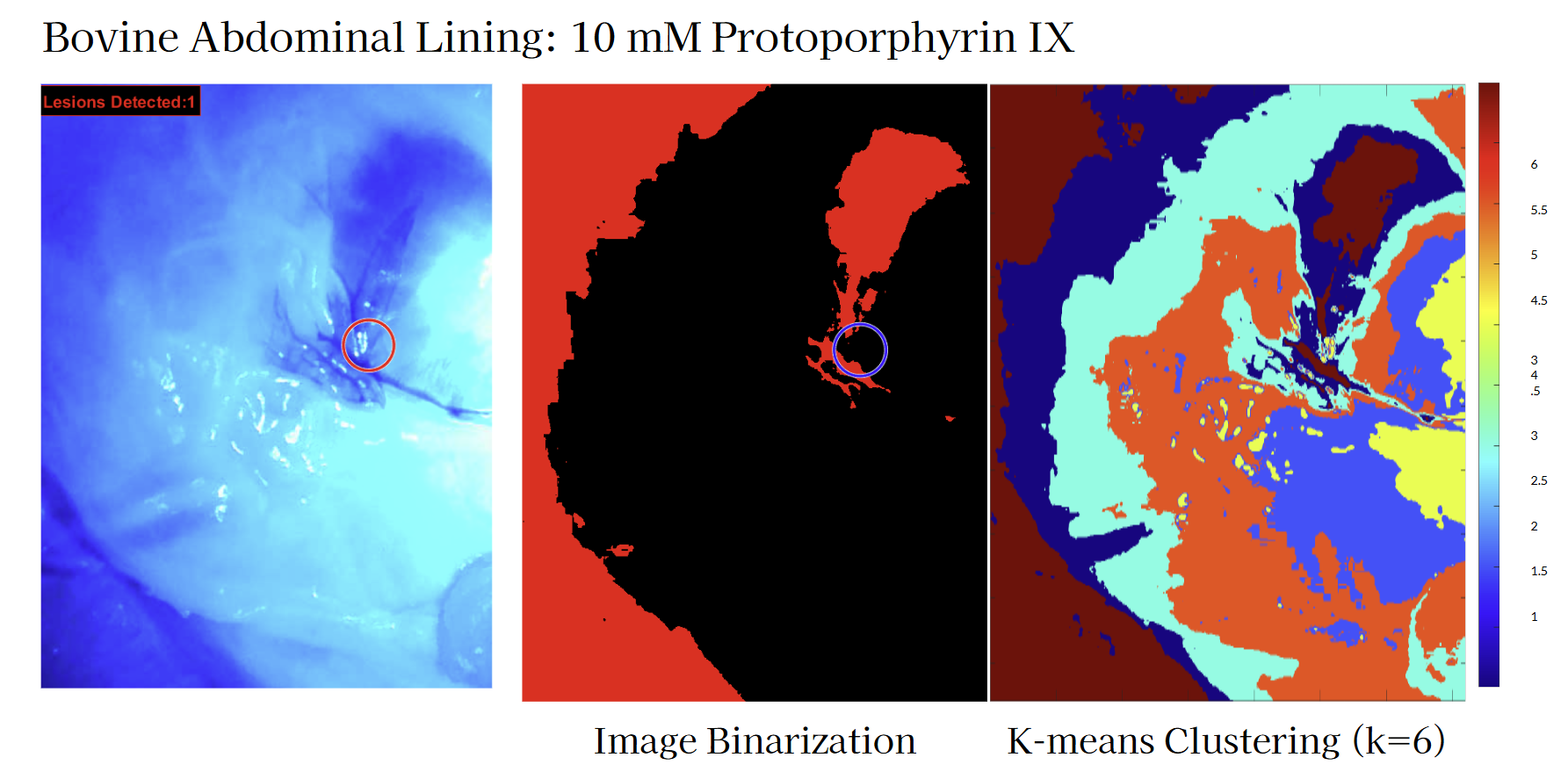 Endoptix Testing Results